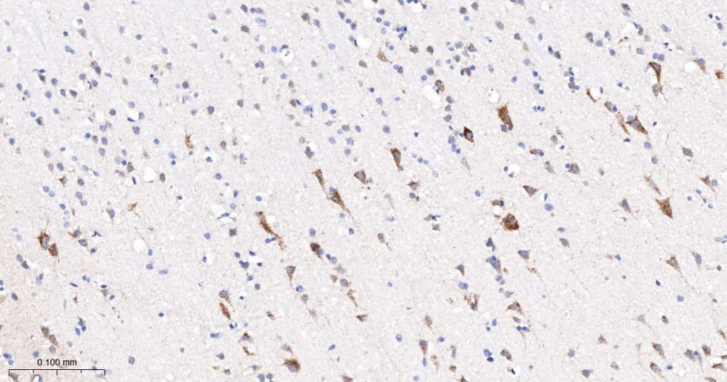 人丙酮酸脱氢酶激酶亚型2即用型免疫组化试剂盒-IHC0692H